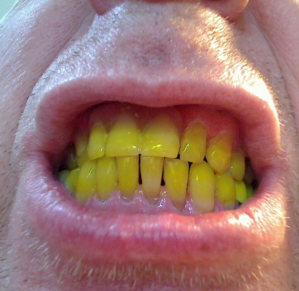 yellow teeth smile