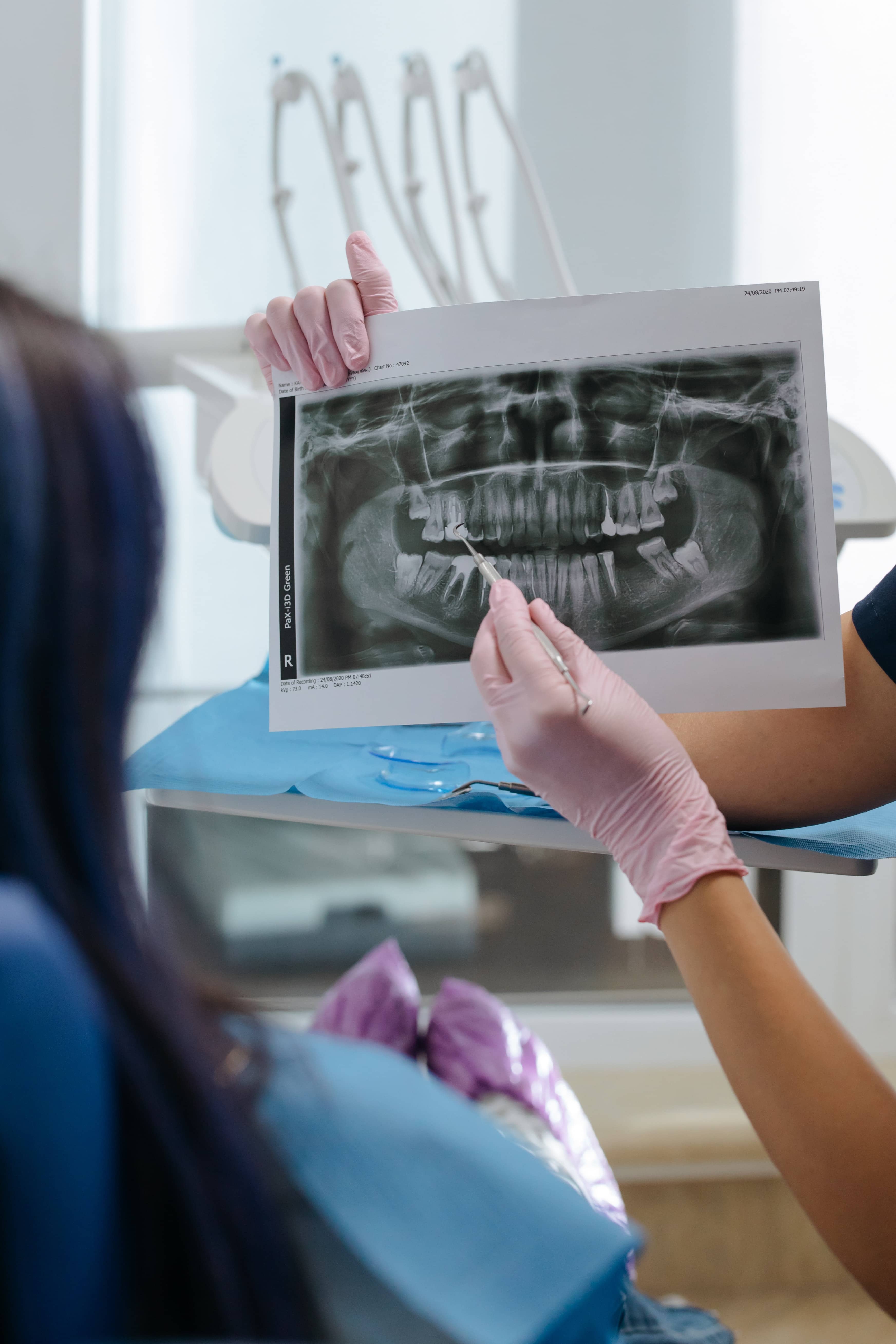 Why Do I Need X-Rays at My Dental Check-Up?