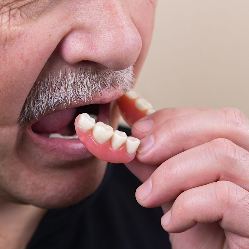 What You Need to Know About Taking Care of Your Dentures