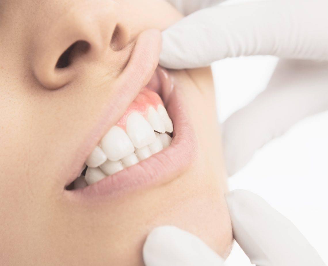The Surprising Link Between Oral Health and Overall Well-Being