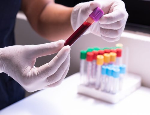 What Pre-Op Lab Work Can Tell Us About Your Ability to Heal