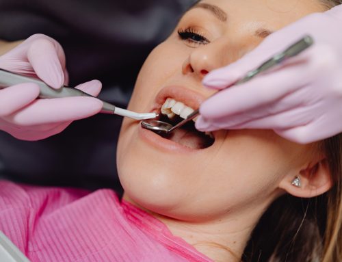 What the SMART Protocol Involves During Amalgam Filling Removal